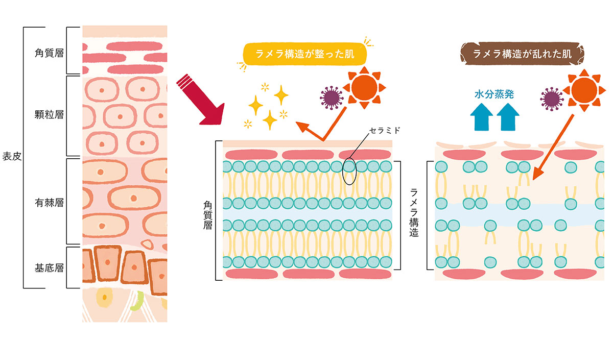 セラミド